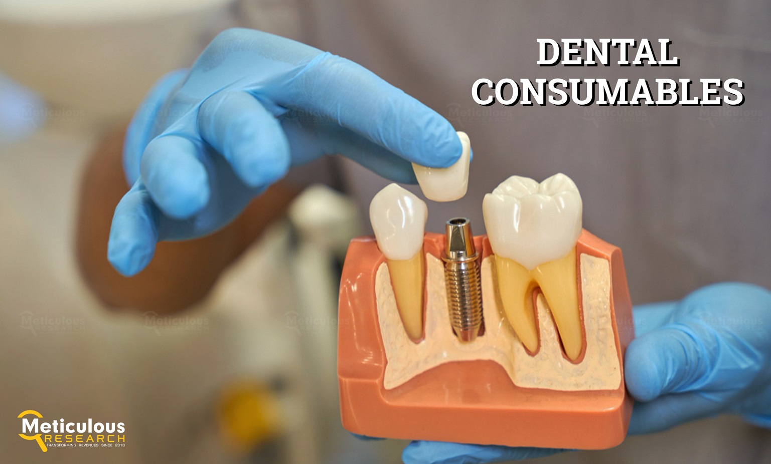 Asia-Pacific Dental Consumables Market